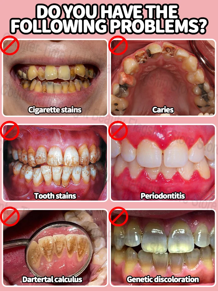 Get white, sparkling teeth fast！