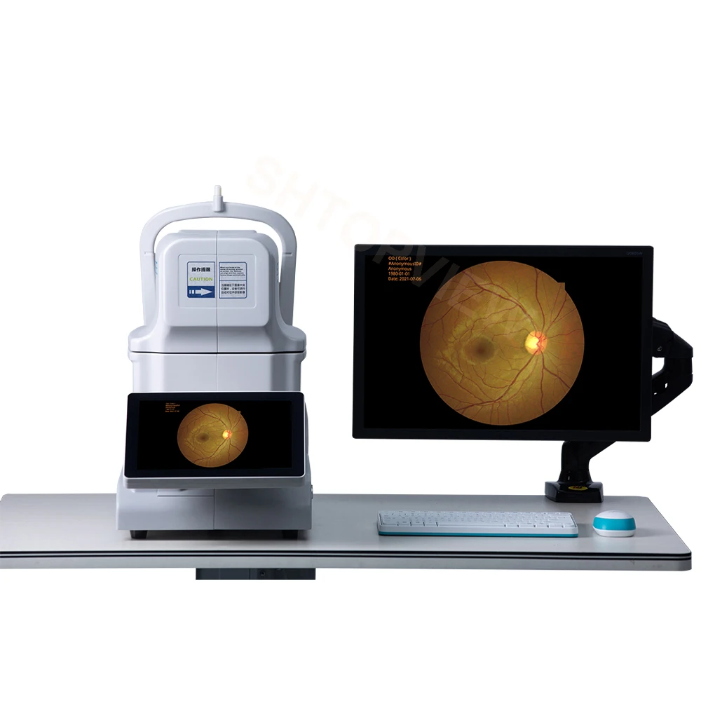 One-click Operation Automatic Fundus camera- Retinal camera- With Puzzle function