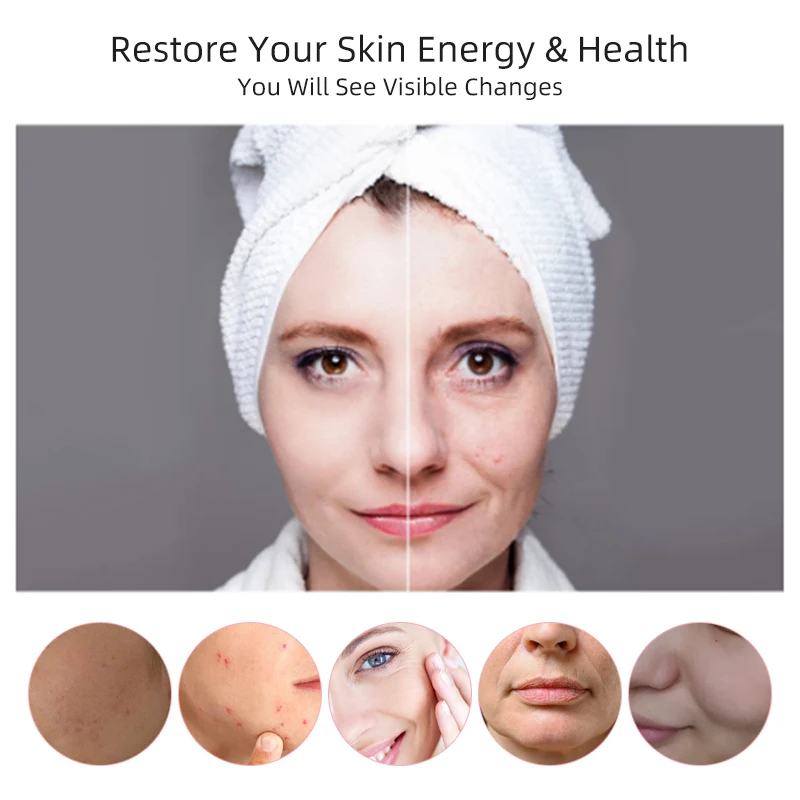 Mesotherapy Electroporation RF Radio Frequency Facial LED Photon Skin Care Beauty Device Face Lifting Tighten Wrinkle Removal