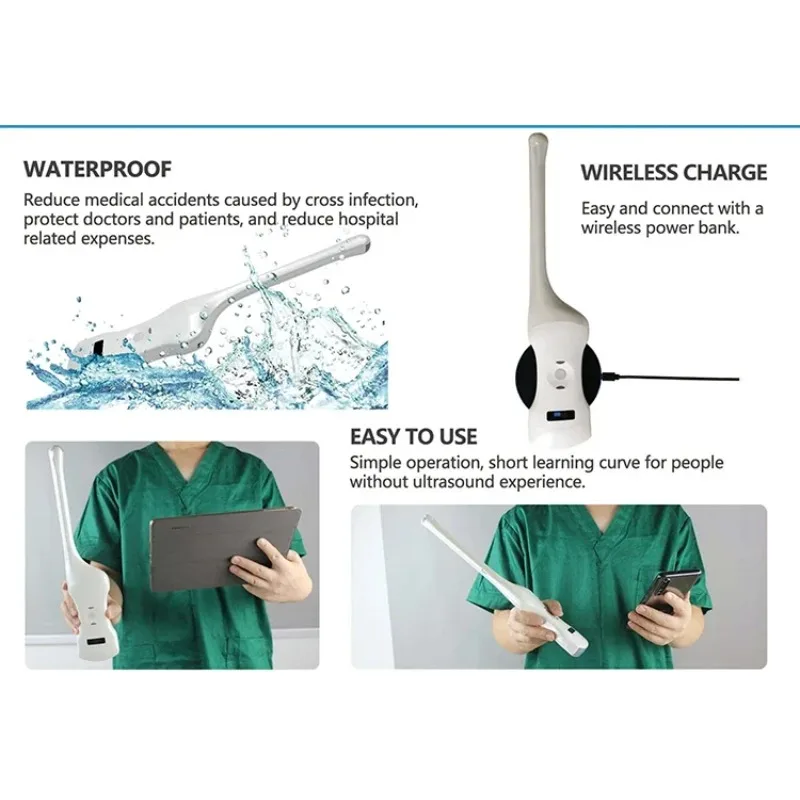 Portable Wireless Mini Ultrasound Diagnostic Equipment with Electric Power Source for Bladder Probe Medical Use