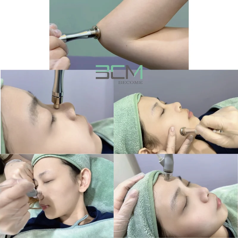 スマートライブラリーダイヤモンドチップマイクロダーマブレーションデバイス、真空吸引機能付きで効果的な黒ずみ除去と毛穴洗浄を実現