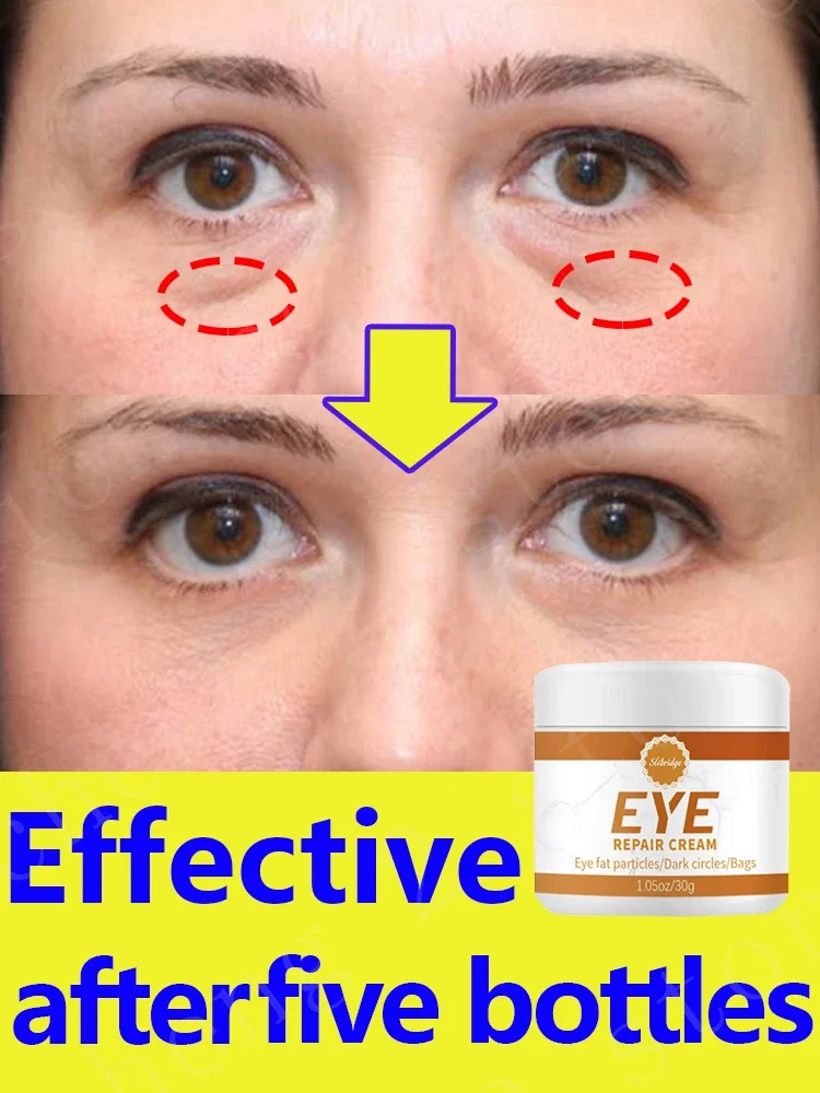 

Eye Care Products