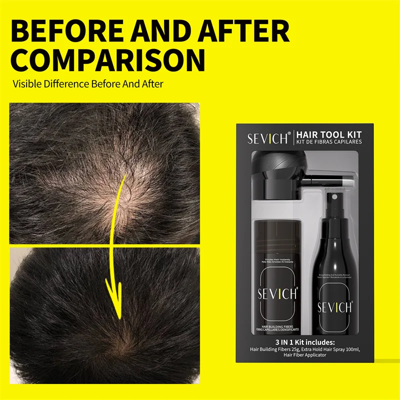 مجموعة ألياف بناء الشعر أصلع تصفيف الألياف مساحيق الشعر تساقط الشعر الألياف عبوة رذاذ مسحوق ألياف الشعر قضيب ترقق الشعر #5
