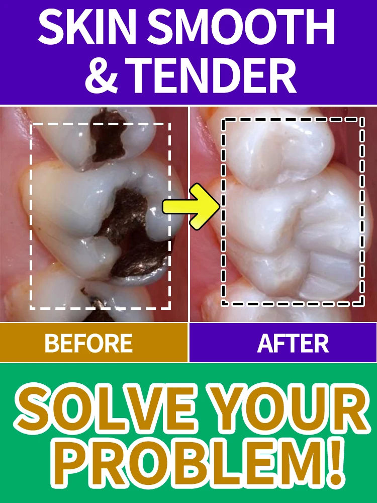 

tooh Decay repair，Teeth repair toothpaste, effective for seven days