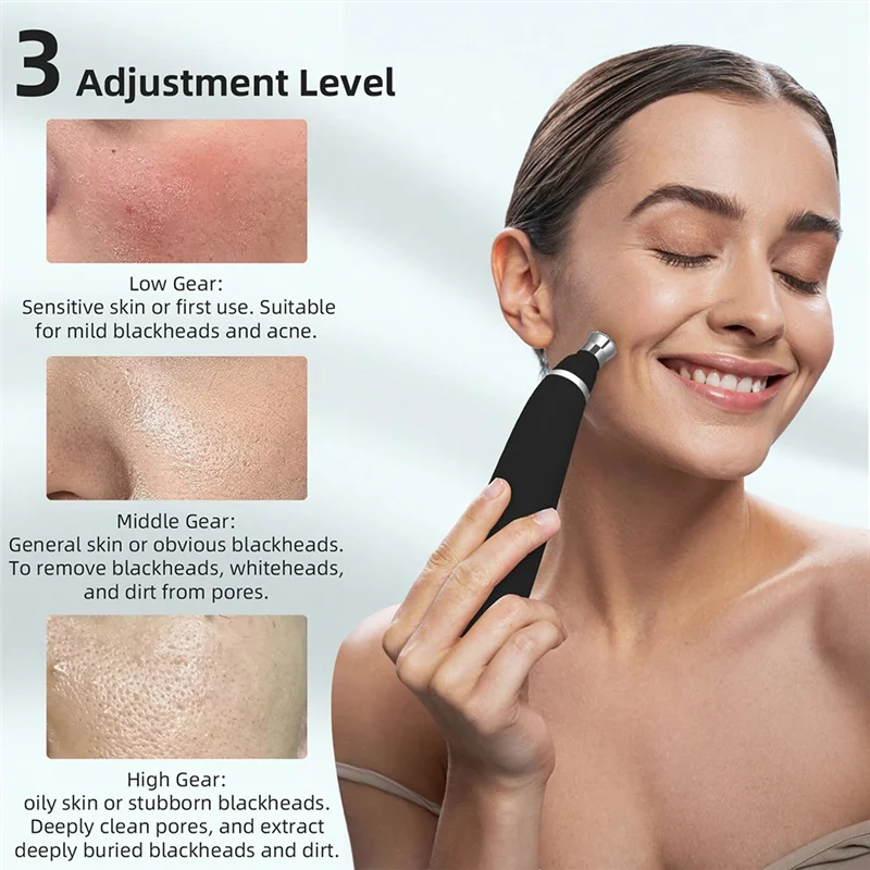 เครื่องขัดผิวหน้าแบบพกพา A02V-Blackhead Removal กำจัดสิวเสี้ยนด้วยระบบไมโครเดอร์มาเบรชั่น พร้อมชุดอุปกรณ์