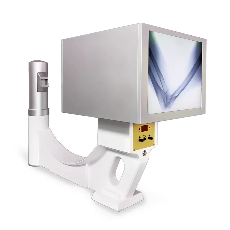 SHO-X-Star(5KW)  DR 5KW 0.5mA Portable Mobile Digital Medical Xray Radiology Machine