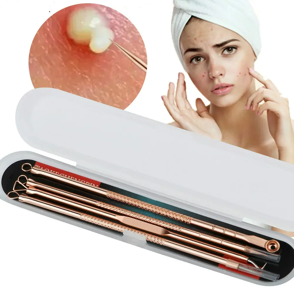 Rose Gold 4pcs/set Blackhead Comedone Acne Pimple Belmish Extractor Vacuum Blackhead Remover Tool Spoon for Face Skin Care Tool