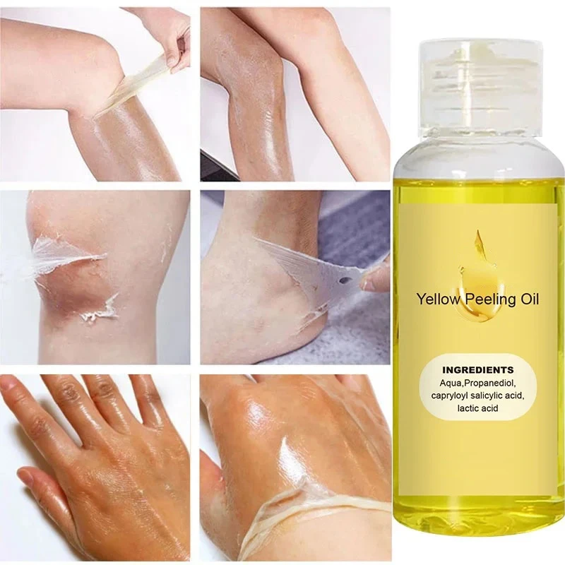 Aceite exfoliante amarillo para el cuidado corporal, blanqueamiento rápido 100%, suero orgánico para piel oscura, nudillos oscuros, Cosméticos Coreanos