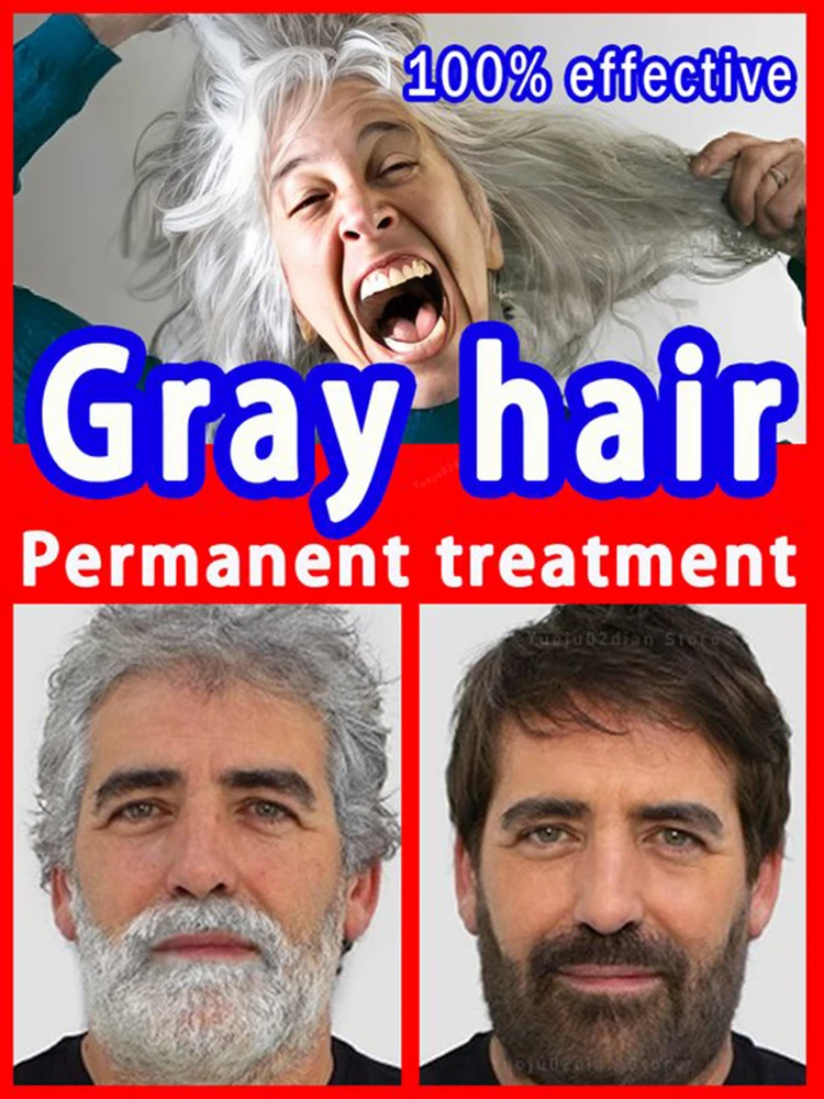 

Anti-grey hair essence Serum treatment restore natural hair color and restore healthy White To Black hair