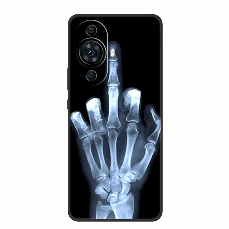 For Huawei Nova 12s Case Popular Black Silicone Soft Back Cover Case For Huawei Nova 12s Phone Case Cover Nova12s 12 s Funda 6.7