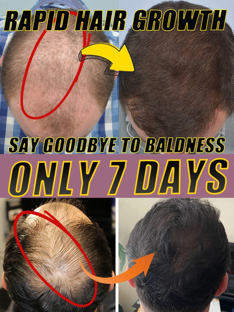 

Wᴀɴᴛ ᴛᴏ ɢᴇᴛ ʀɪᴅ ᴏғ "ᴛʜɪɴ ʜᴀɪʀ" Cʜᴏᴏsᴇ ᴛʜɪs! Eᴀsɪʟʏ ɢᴇᴛ ᴛʜɪᴄᴋ ʜᴀɪʀ