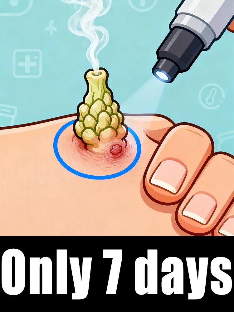 

Hᴏᴛ sᴇʟʟɪɴɢ ʙʟᴜᴇ ʟɪɢʜᴛ ᴘᴇɴ ᴛᴏ sᴏʟᴠᴇ ʙᴏᴅʏ ᴡᴀʀᴛs, ᴡᴀʀᴛ ᴄᴀʀᴇ ᴛᴏᴏʟs