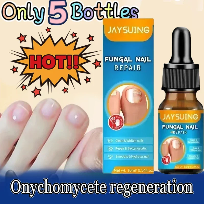 Fungal Nail Treatment Oil Foot Repair Essence Toe Nail Fungus Removal Gel Anti Infection Cream Fungal Nail Removal