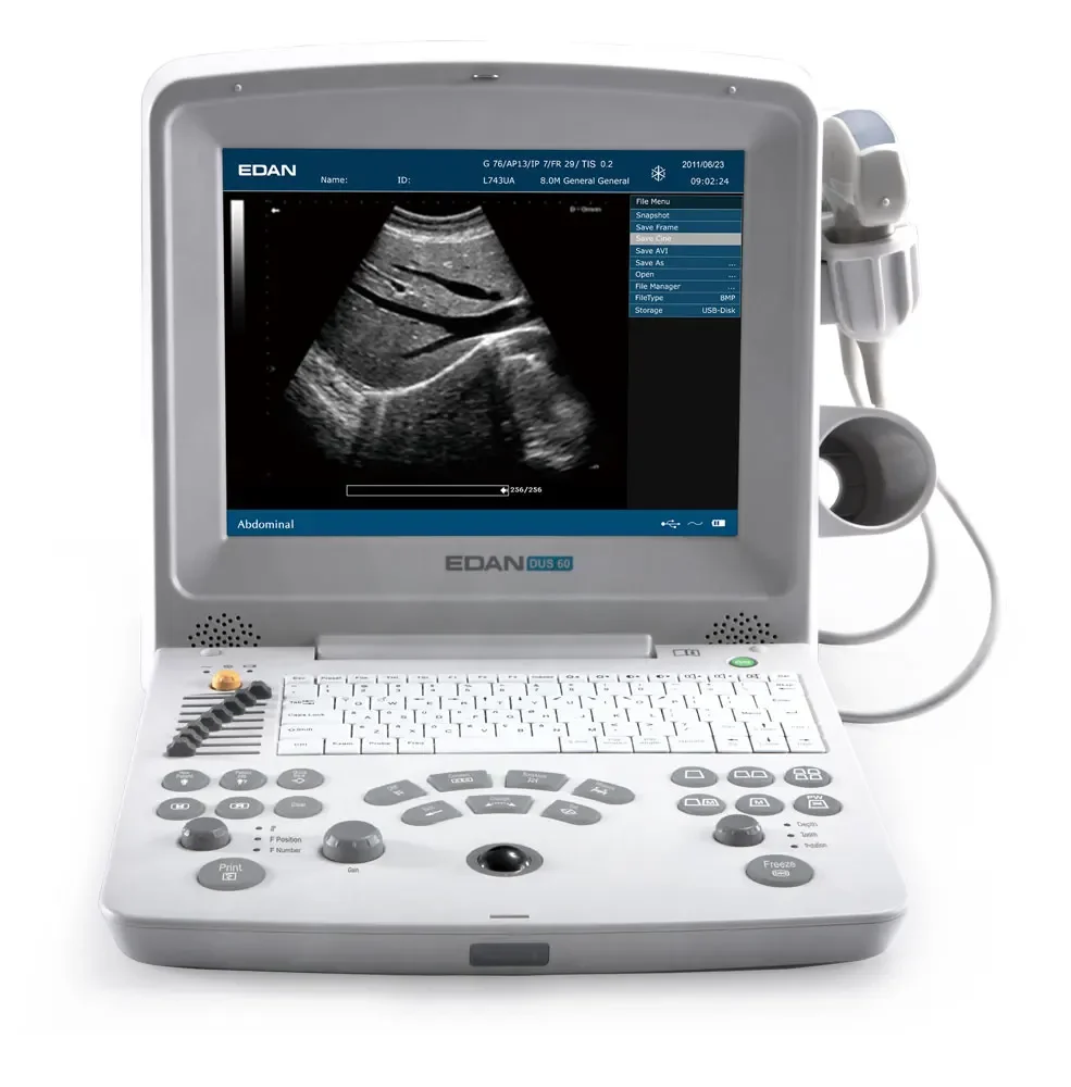 Draagbare Edan Ultrasound Machine Zwart-wit Ultrasound Machines