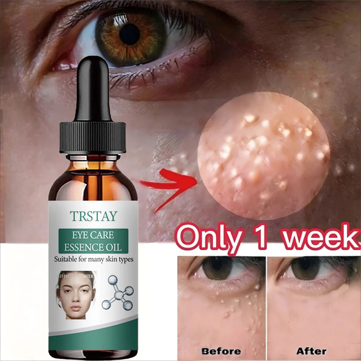 

TRSTAY Эссенционное масло для ухода за глазами. Универсальное решение для типа кожи для области вокруг глаз. Уход за кожей для беременных и беременных.