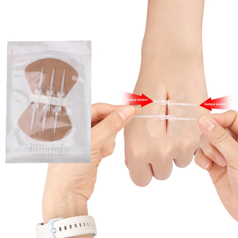 

Zipper Band-aid Painless Wound Closure Device Suture-free Wound Dressing Patches Zip Suture Reducer Band Aid