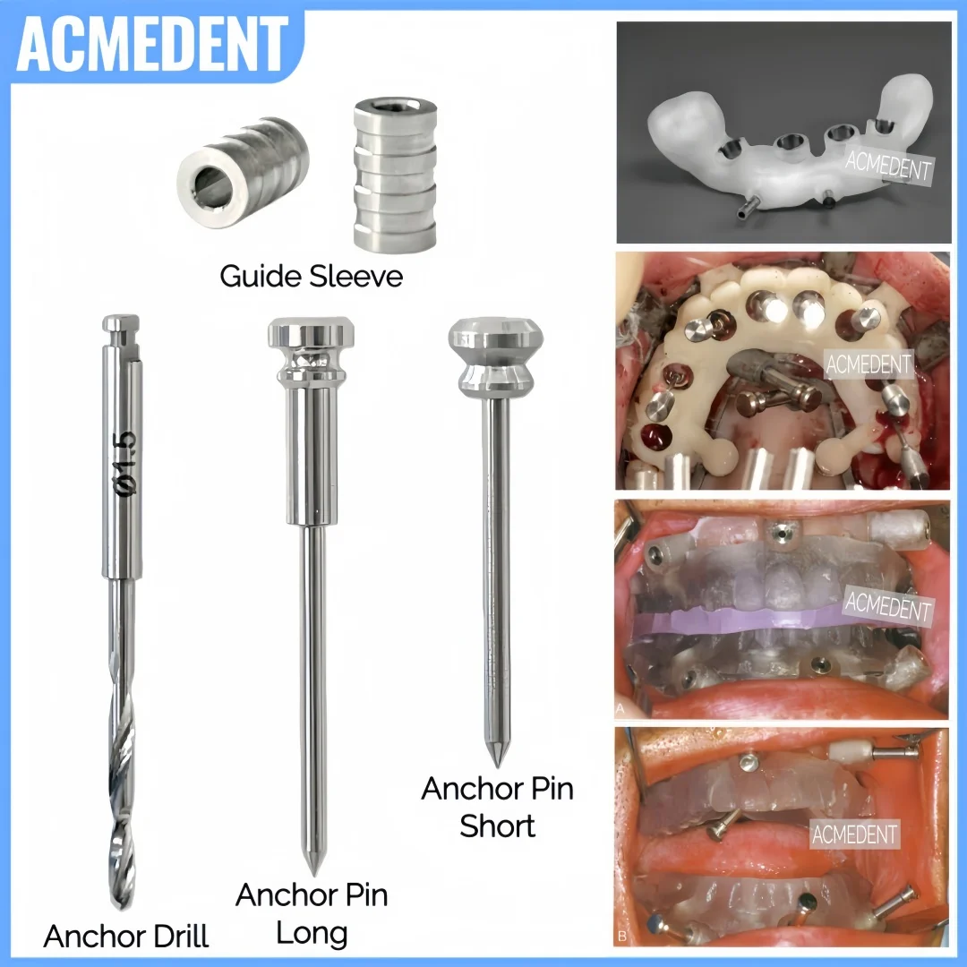 

⌀1.5 Dental DSG Anchor Pin Fixation Drill Guided Sleeves Locator Tool Implant Denture Fixed Implant Plate Fits 3DDX Guided Kit