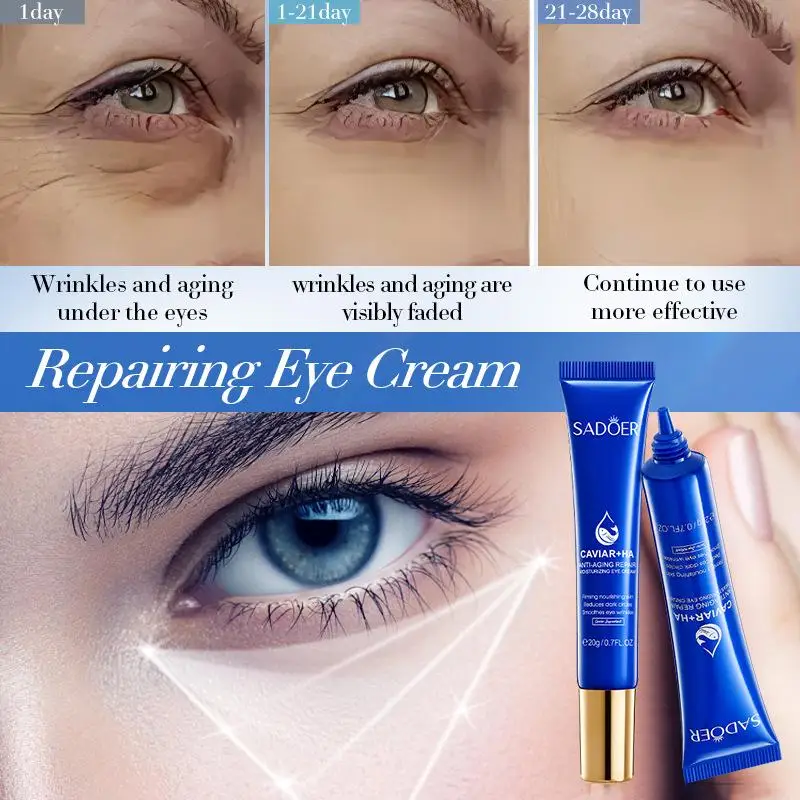 New 20g SADOER Caviar Hyaluronic Acid Eye Cream Anti Dark Circles Removal Eyes Bags Anti-aging Moisturizing Eyes Skin Care - view 5