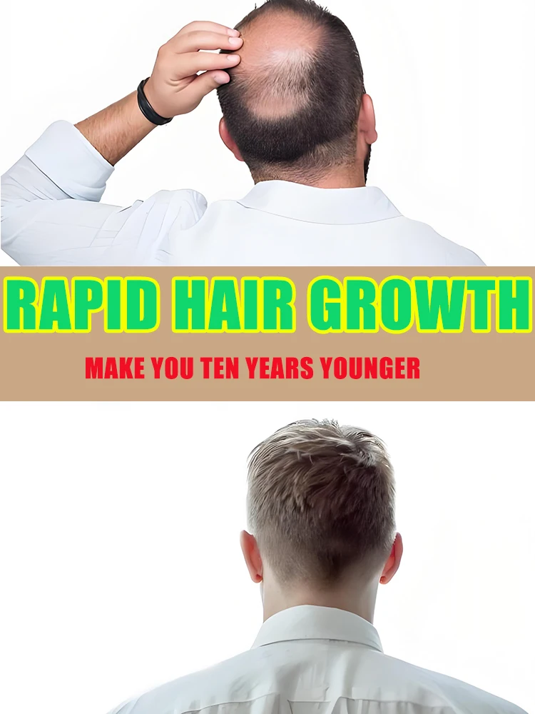 

Aɴᴛɪ ʜᴀɪʀ ʟᴏss, ʜᴀɪʀ ғᴀsᴛ ɢʀᴏᴡᴛʜ ɴᴜᴛʀɪᴛɪᴏɴ ᴇssᴇɴᴄᴇ