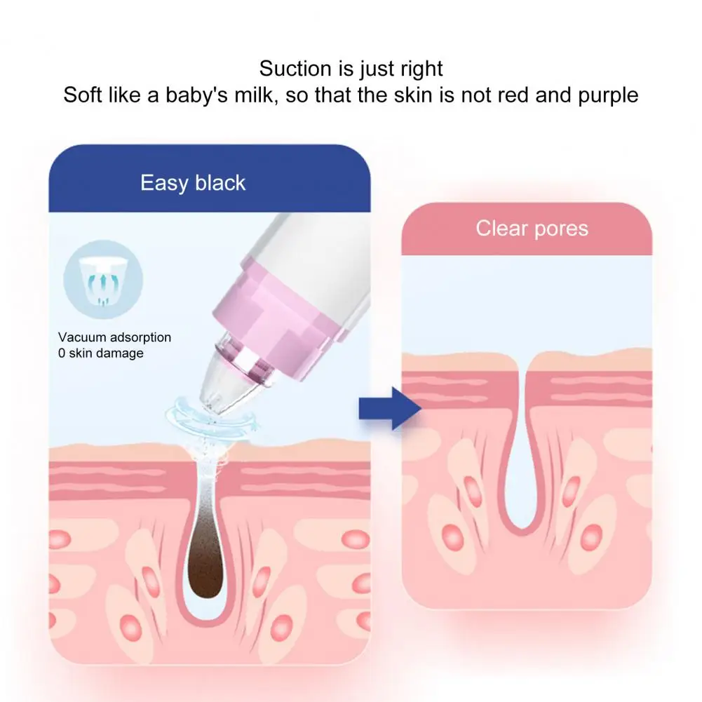 Điện Đầu Đen Tẩy Hút Mạnh Mẽ Làm Sạch Lỗ Chân Lông Làm Đẹp Thiết Bị Hút Mụn Mặt Nâng Dụng Cụ Chăm Sóc Da Công Cụ