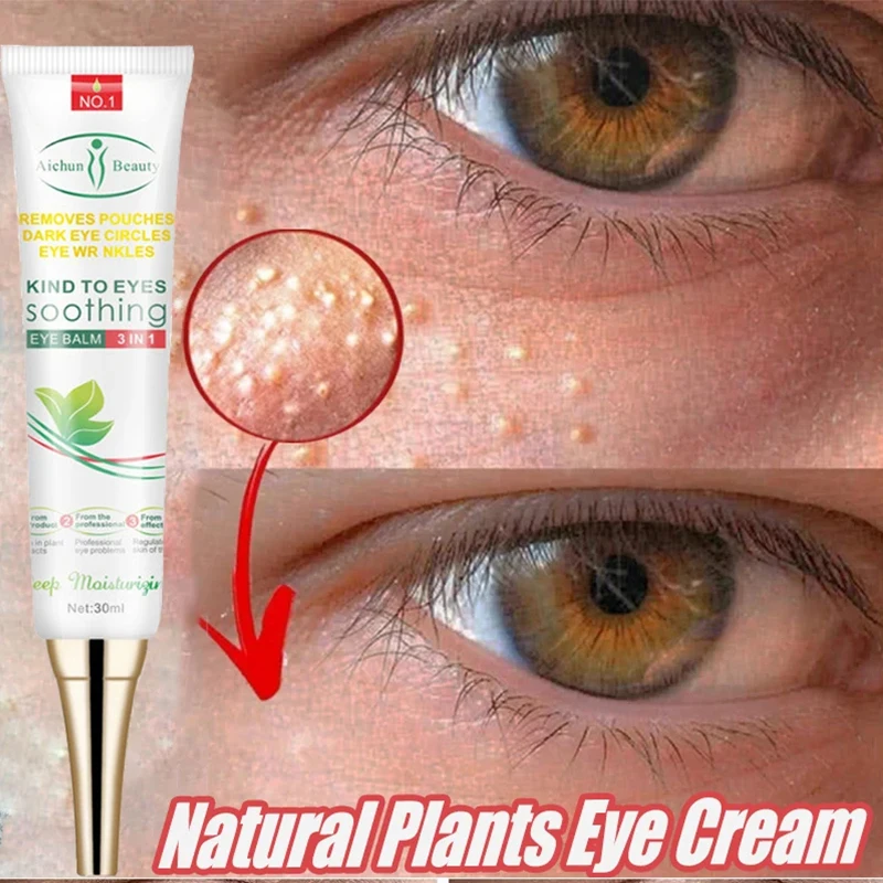 Anti-inchaço grânulos de gordura removedor rugas creme para os olhos elevador endurecimento desbotamento linhas finas anti-idade círculos escuros produtos de cuidados com os olhos