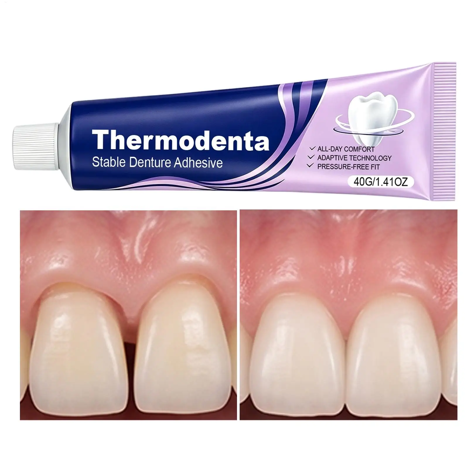 Denture Adhesive 40g Long Lasting Strong Grip Comfort Secure Denture Adhesive Cream for Men Women Elderly Home Daily Party