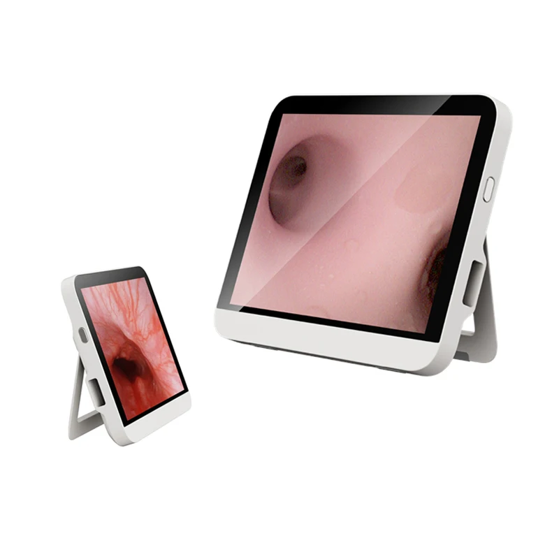 Image 6: Bronchoscope vidéo jetable de prix de bronchoscope flexible portatif numérique d'utilisation unique de Euprun