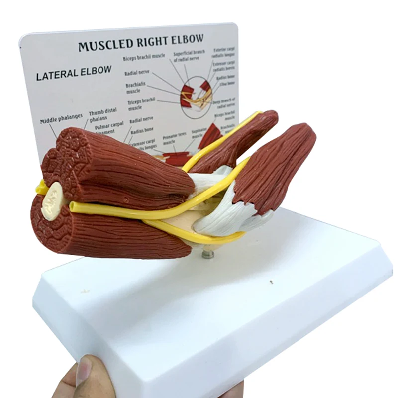 

A functional model of nerve-ligaments in human muscles, elbows, joints