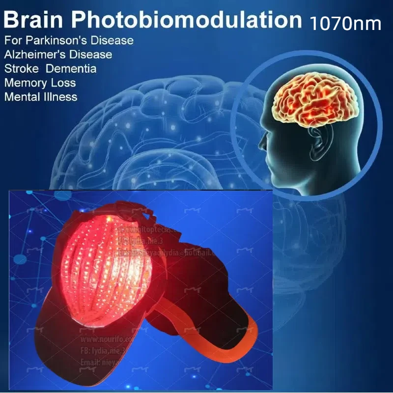 Photobiomodulation Brain Therapy Helmet 1070nm Near-infrared Light Therapy for Traumatic Brain Injury Stroke Parkinson