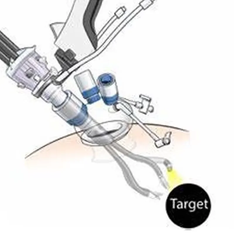 Robotic Single Port 5mm & 12mm Multi-Channel Trocar for Robotic Surgery Manual Power Source Medical Supplies