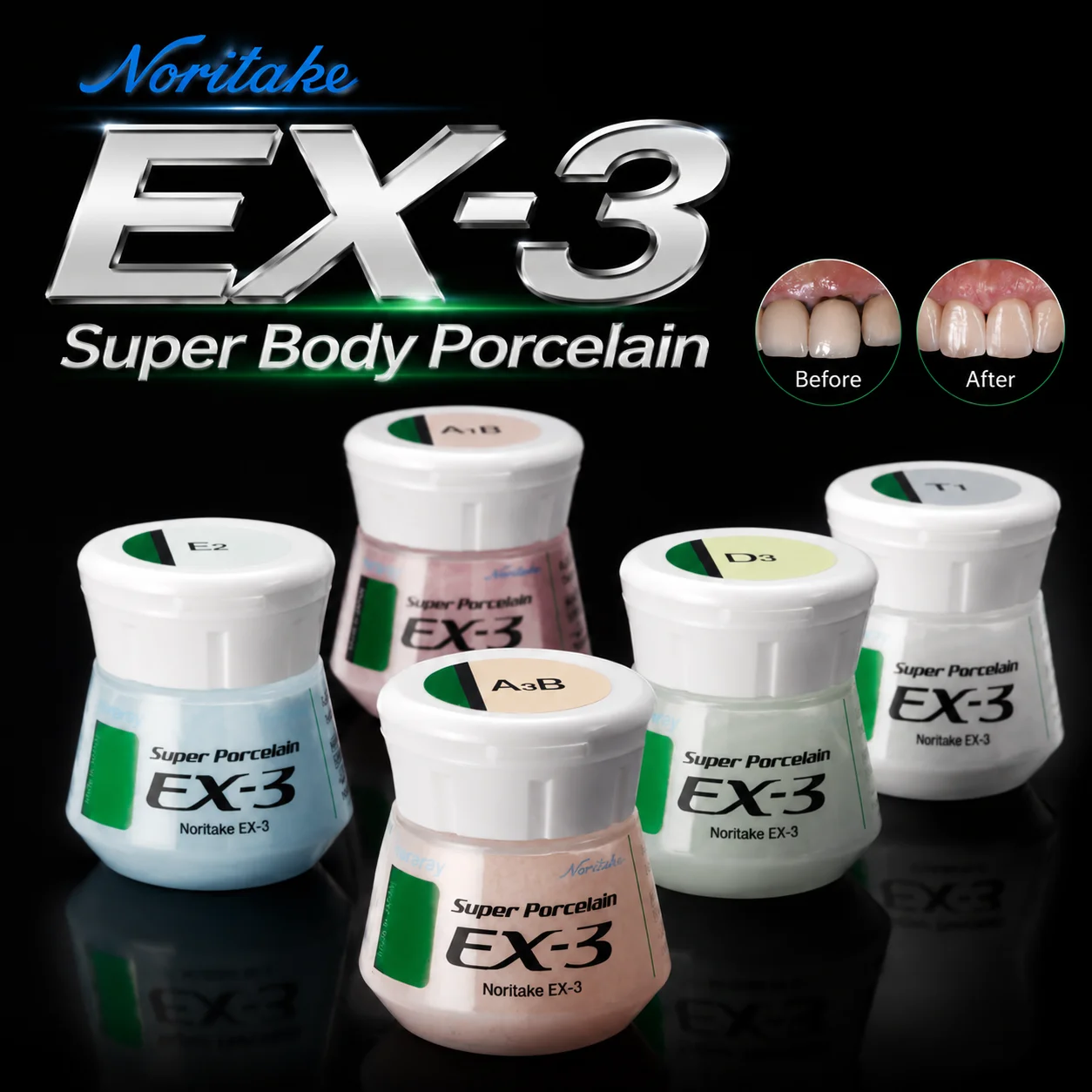 Noritake EX-3 Super Body Porcelain  Powder 50g Multi Shades A1B A2B E2 TX PFM Crown Bridge Ceramic Restoration Material