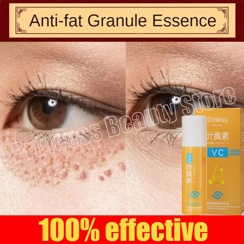 Fat Granules Removal Eye Serum Anti Dark Circle Eye Bags Fade Fine Line Essence Anti-Puffiness Moisturizing Skin Care Products