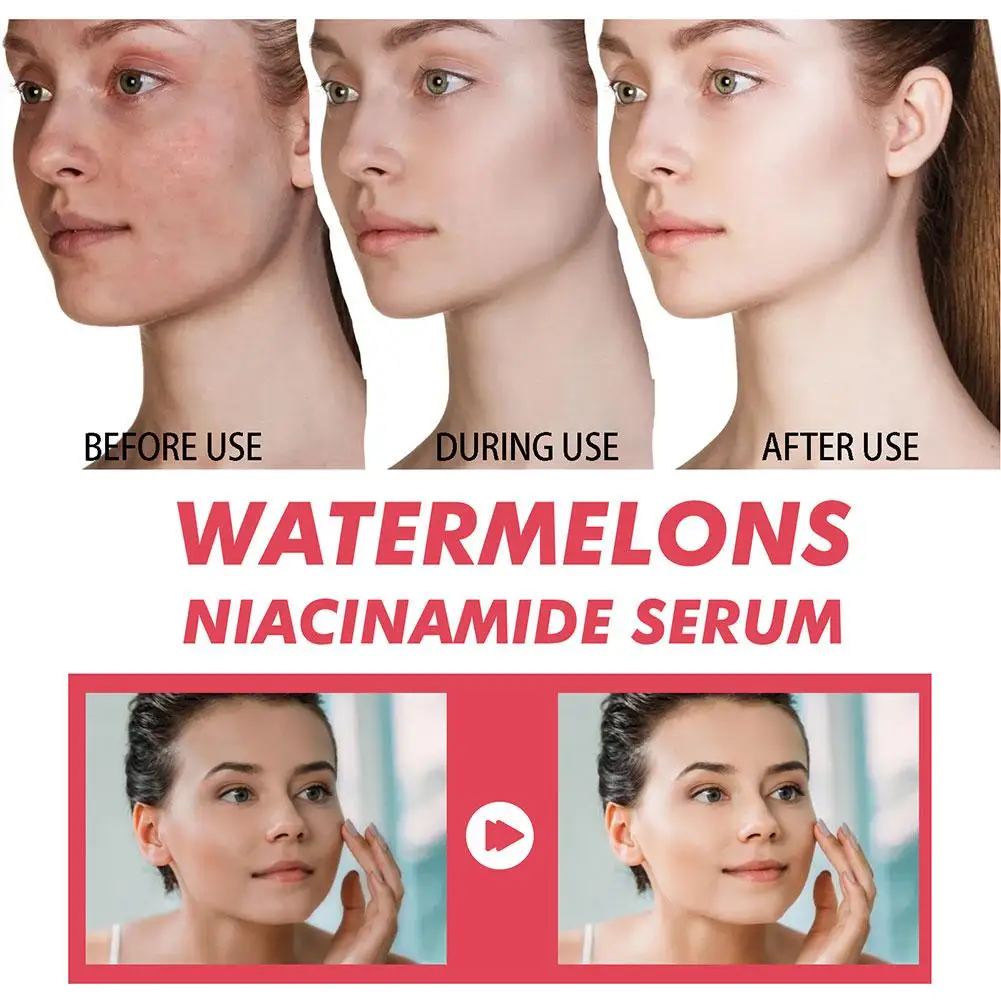 Eelhoe 60มล. แตงโมเรืองแสง Niacinamide น้ำค้างเซรั่มไพรม์เซรั่ม Rias wajah highlighter ใบหน้าน้ำหนักเบา H3R2ให้ความชุ่มชื้น