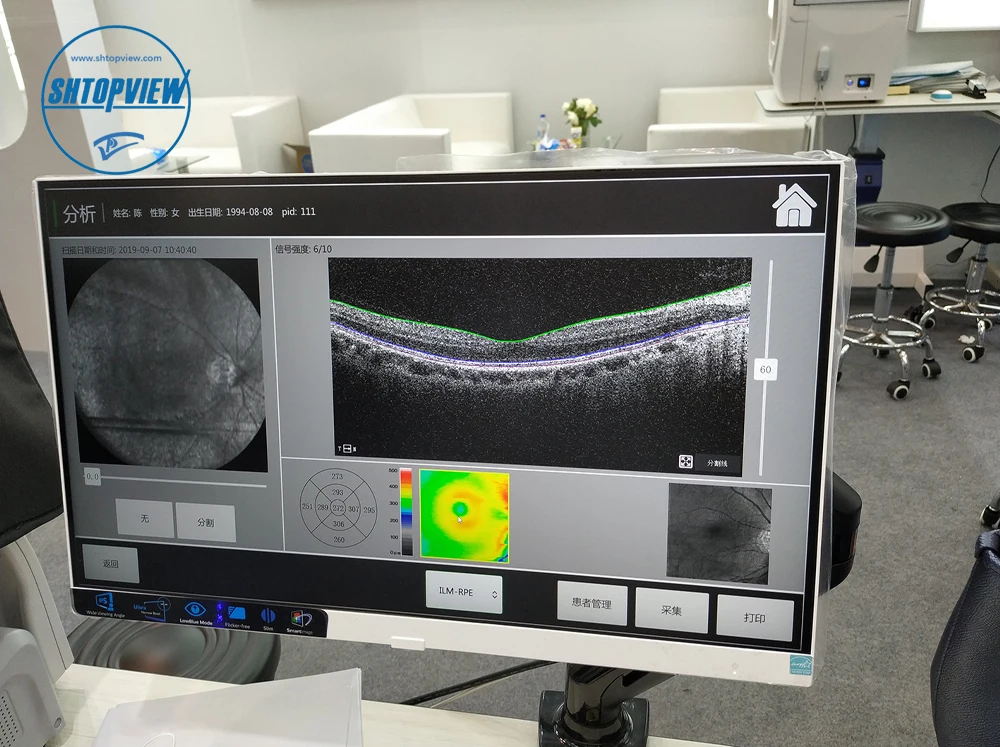 SHTOPVIEW الجزء الخلفي للعين OCT التصوير التوافق البصري مع Retiview الكمبيوتر المدمج 500