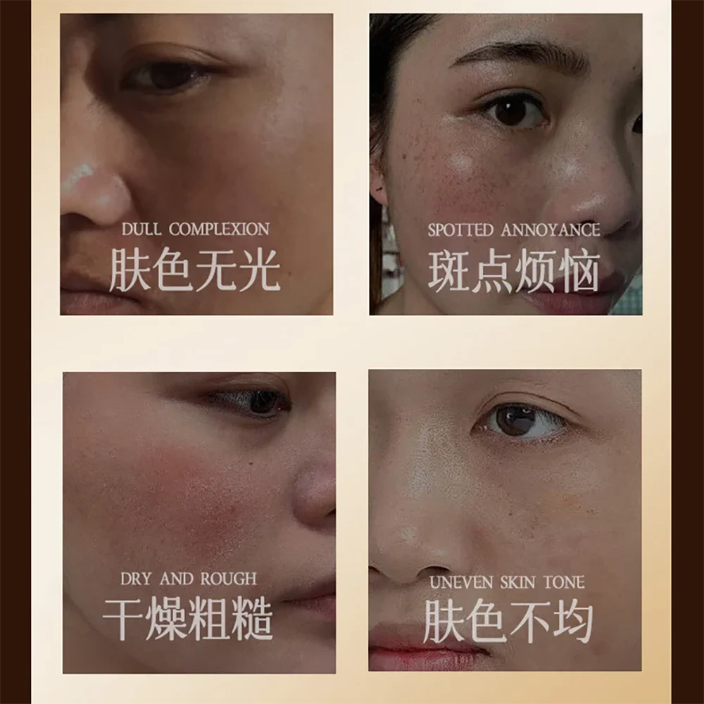 Lady Cream Concealer Face Skin Brighten Cream Chloasma Freckles Sunburn Dark Spots Melanin Moisturizing Skincare Facial Cream