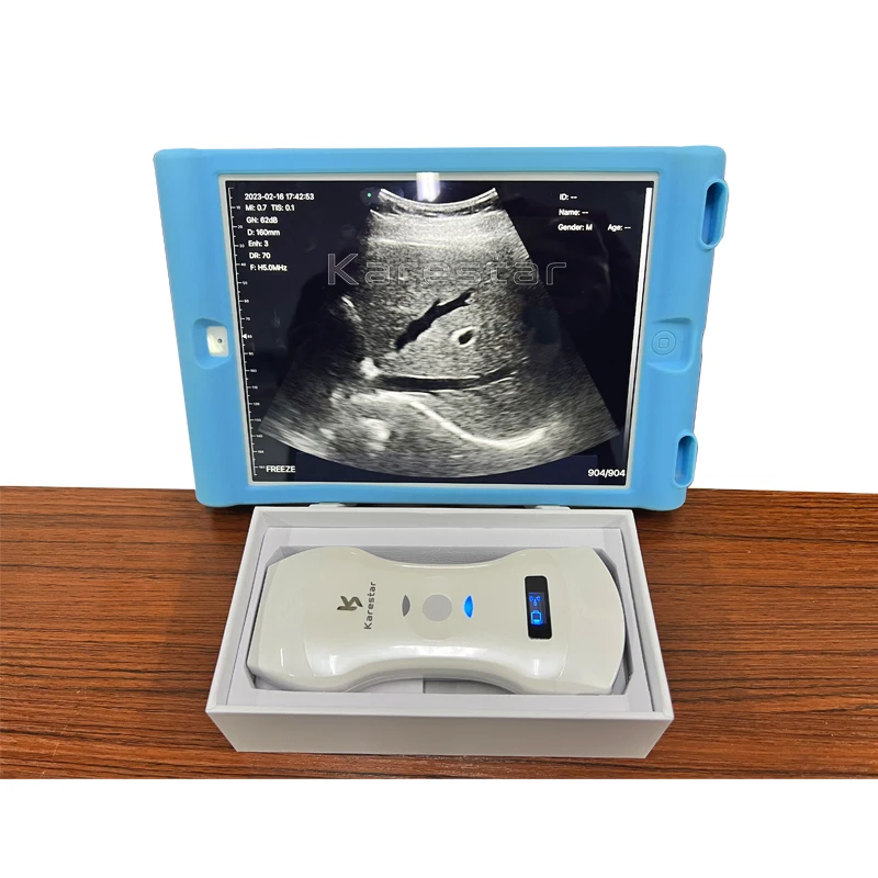 K-TC101 veterinary machine portable medical ultrasound instruments Super clear image 3 in 1 wireless wifi ultrasound