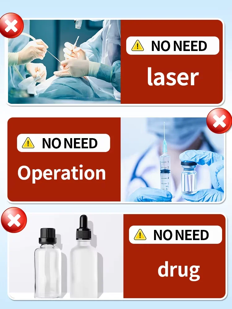 2025-spray voor het verwijderen van tatoeages Gepigmenteerde permanente make-up-tatoeageverwijdering