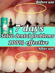 Protect gums and prevent tooth decay, effectively repair gums