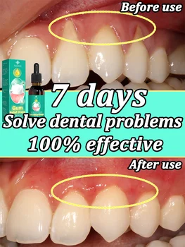 להגן על החניכיים ולמנוע עששת, ביעילות לתקן חניכיים