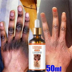 50ml Dark Knuckles Fast Whitening Serum Hand Knuckle Melanin Corrector Intense Stains Remover Product For Black Skin Beauty Care