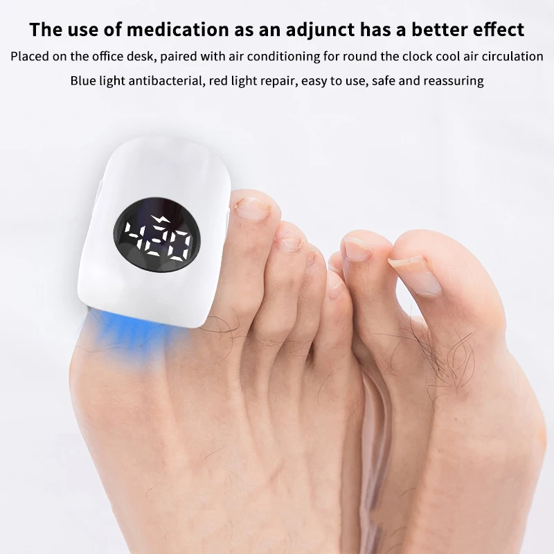 USB Charging Nail Fungus Treatment Device-930nm Infrared & 470nm Blue Light LED Laser Onychomycosis Nail Care Phototherapy Lamp