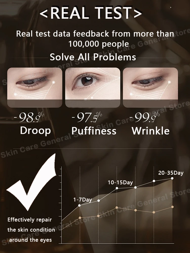 Eye Bags Cream Remove Eyes Wrinkle