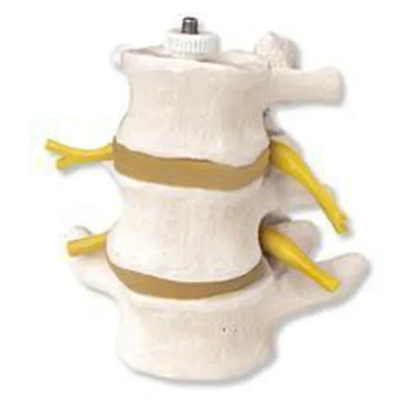 3-Segment Lumbar Spine Skeleton Model Lesions Intervertebral Disc Skeleton Spine Medical Model Teaching Aid Education