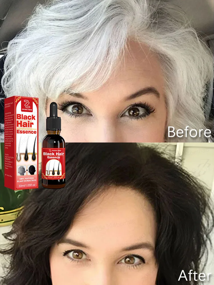 7 DAYS TO GET RID OF GREY HAIR AND RESTORE YOUR NATURAL HAIR COLOUR Turn grey hair black healthily and quickly.