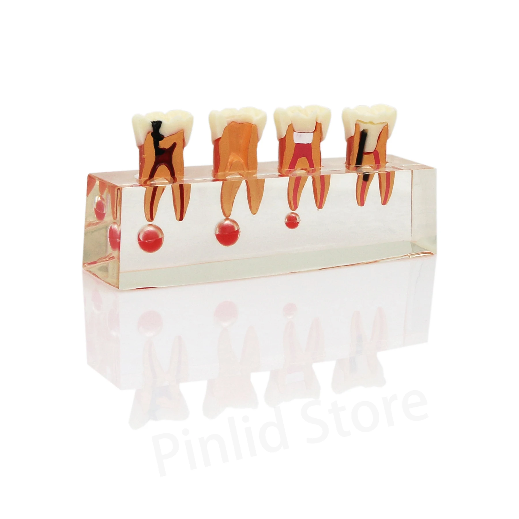 

Dental Model M4018 Dental Pathology Patient Endodontic Classification Clear demonstration of research and teaching