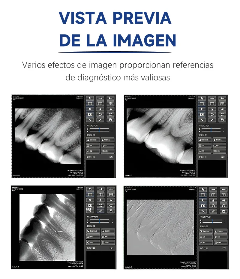 High-Frequency Dental Sensor X-Ray Radiovisiograph Rx Digital Intraoral Digital System Image Dentistry Tool