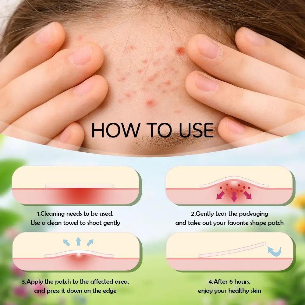 برتقالي اللون رائعتين فتاة الإبداعية حب الشباب بقع لطيف وغير مزعجة منتج العناية بالوجه 2026 جديد 220 قطعة