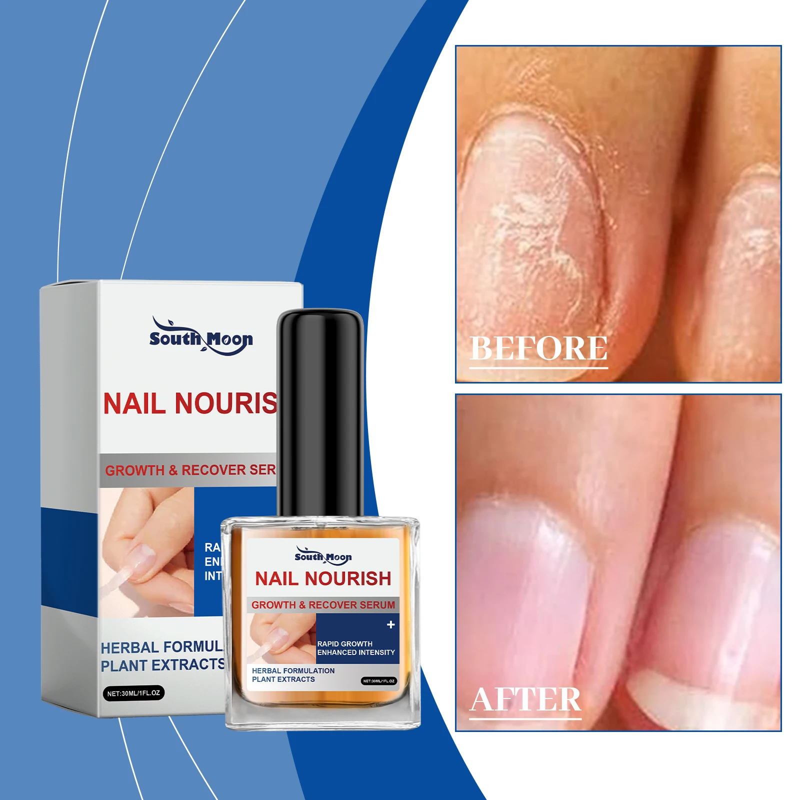 爪の成長血清 – ハーブ植物エキスによる迅速な爪の回復と強化トリートメント