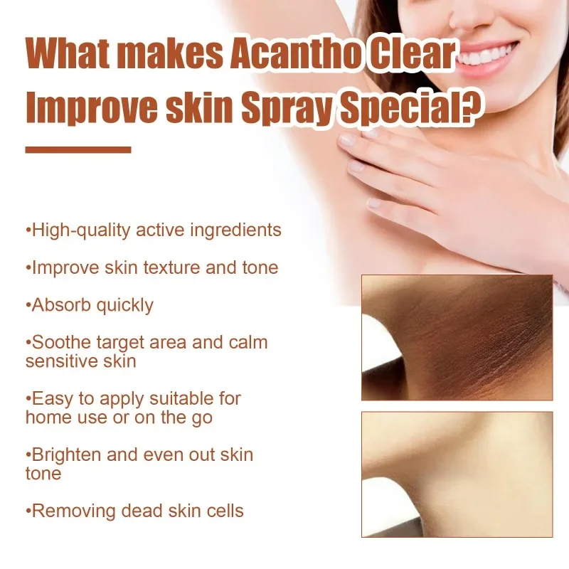 Acantho clear spray Armpit Elbow Knee joint Dark Knuckle Removal Whitening Serum Thigh Inner improve Melanin Dull body skin care