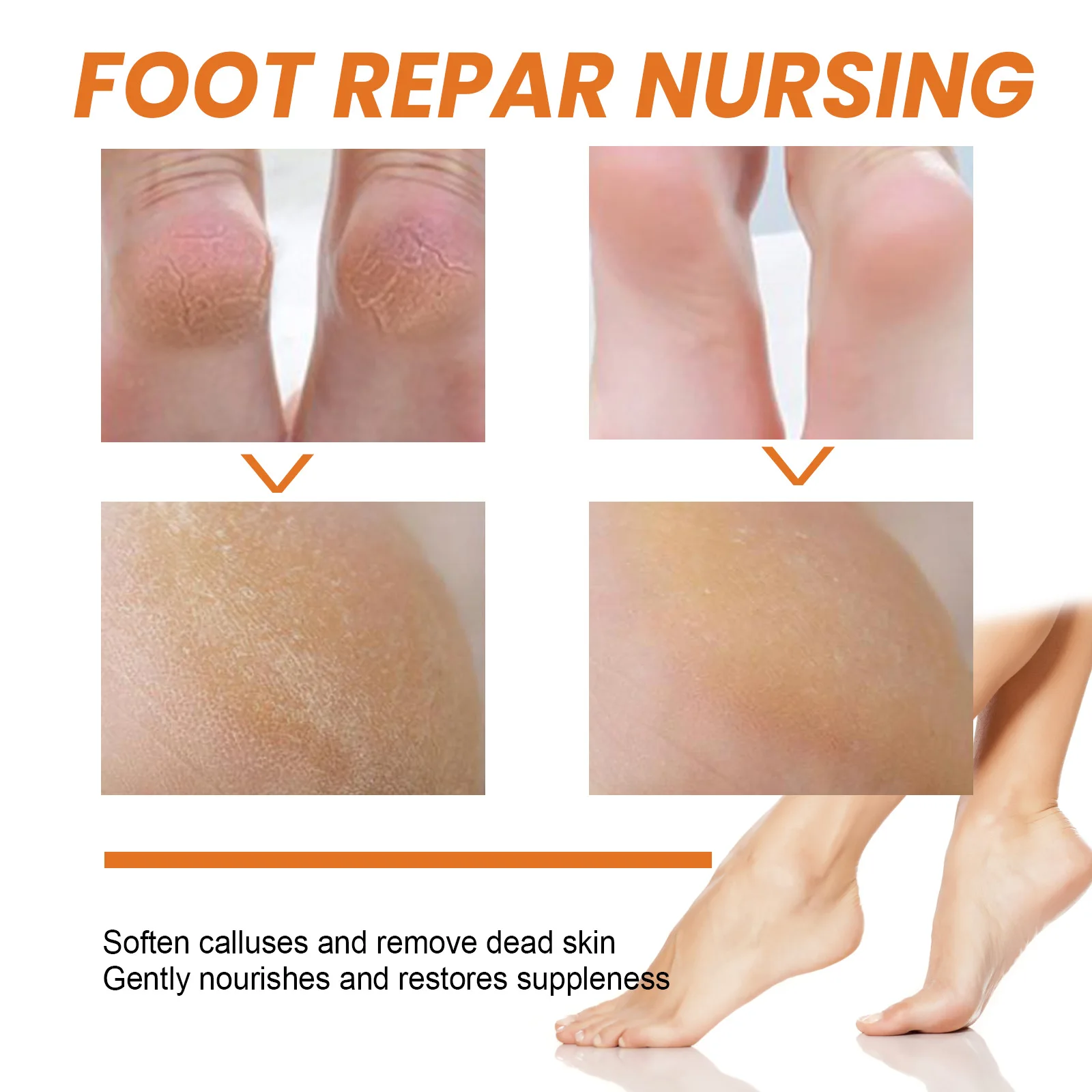 Calluses Remover Foot Spray Anti-Drying Exfoliating Heel Cracked Repair Pedicure Hand Elbow Eliminate Dead Skin Foot Liquid 30ml